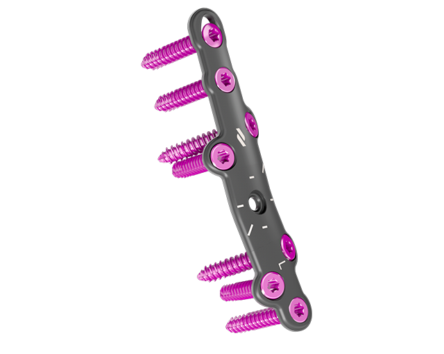 mtp-revision-plates-rollover