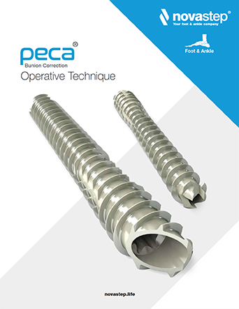 PECA<sup>®</sup> Operative Technique”>
                                                                    </div>
                                <div class=