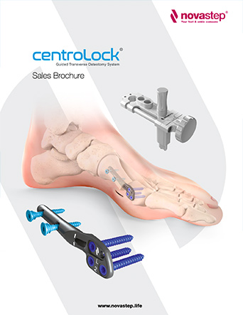 CentroLock Sales Brochure