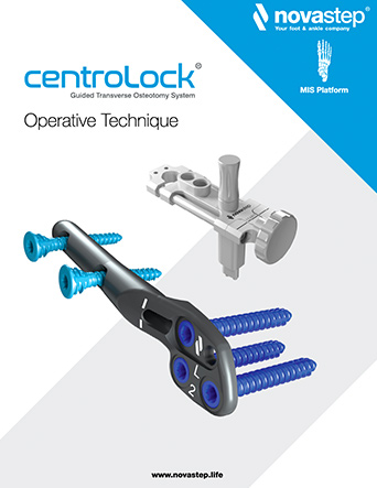 CentroLock Operative Technique