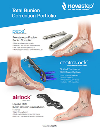 Bunion Solutions