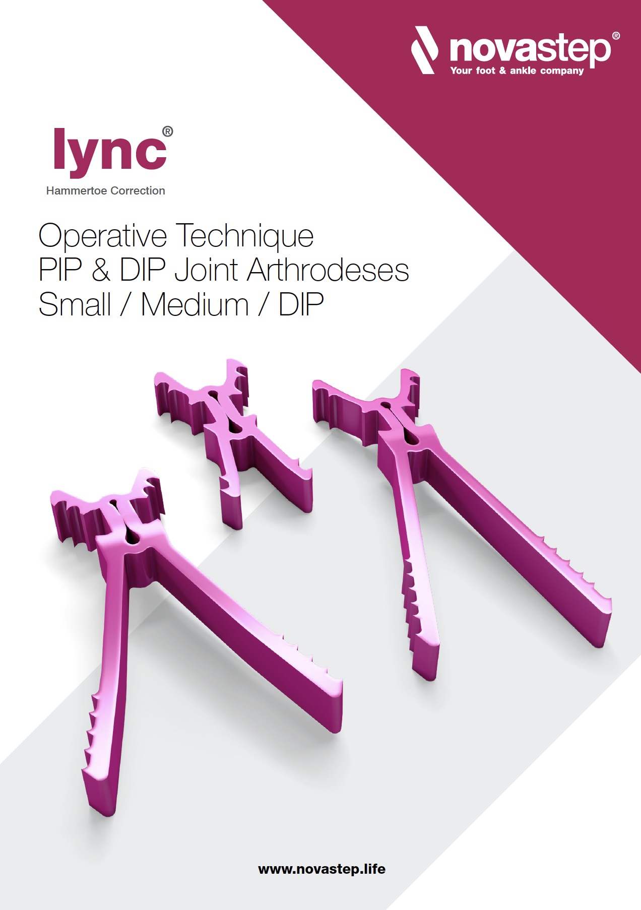 Lync Operative Technique